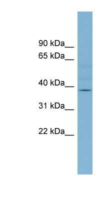 Western Blot: B3GALNT1 Antibody [NBP1-59448]