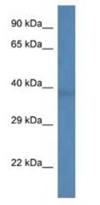 Western Blot: B3GALNT1 Antibody [NBP1-74240]