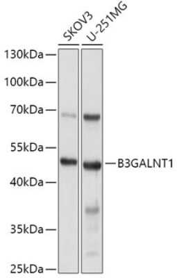 Western Blot: B3GALNT1 AntibodyBSA Free [NBP2-92677]