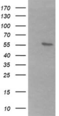 Western Blot: B3GALNT2 Antibody (OTI1G2) [NBP2-45526]