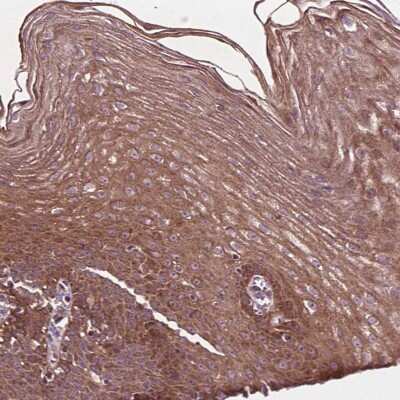 Immunohistochemistry-Paraffin: B3GALNT2 Antibody [NBP2-48972]