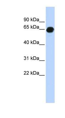 Western Blot: B3GALNT2 Antibody [NBP1-57930]