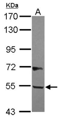 Western Blot: B3GALNT2 Antibody [NBP2-15532]