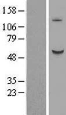 Western Blot: B3GALNT2 Overexpression Lysate [NBL1-07875]