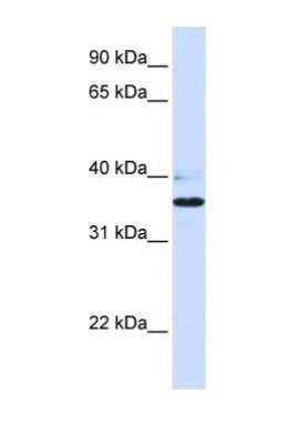 Western Blot: B3GALT1 Antibody [NBP1-69327]