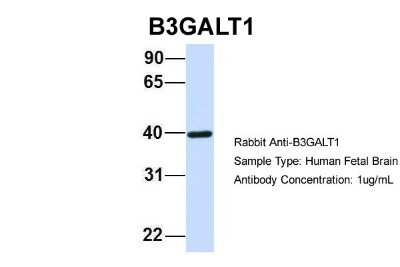 Western Blot: B3GALT1 Antibody [NBP1-69327]