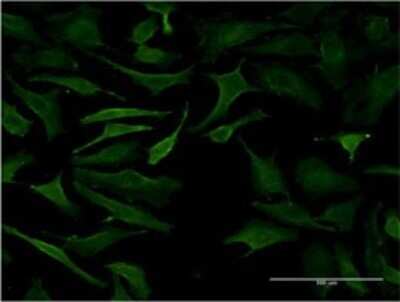 Immunocytochemistry/ Immunofluorescence: B3GALT2 Antibody (1D9) [H00008707-M03]