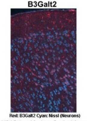 Immunohistochemistry: B3GALT2 Antibody [NBP1-69014]