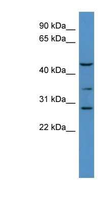 Western Blot: B3GALT2 Antibody [NBP1-69014]