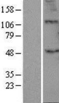 Western Blot: B3GALT2 Overexpression Lysate [NBL1-07877]