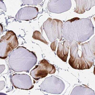 Immunohistochemistry-Paraffin: B3GALT4 Antibody [NBP2-14341]