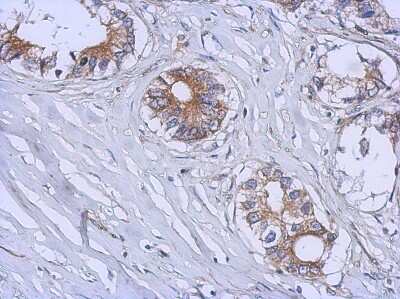 Immunohistochemistry-Paraffin: B3GALT4 Antibody [NBP2-15533]