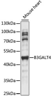 Western Blot: B3GALT4 AntibodyAzide and BSA Free [NBP2-92226]