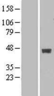 Western Blot: B3GALT4 Overexpression Lysate [NBL1-07878]