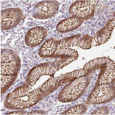 Immunohistochemistry: B3GALT5 Antibody [NBP2-30879]