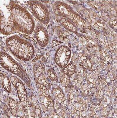 Immunohistochemistry: B3GALT5 Antibody [NBP2-30906]