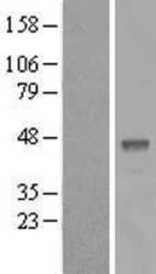 Western Blot: B3GALT5 Overexpression Lysate [NBP2-09943]