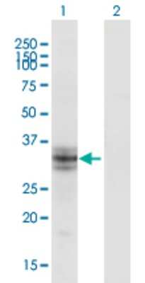 Western Blot: B3GALT6 Antibody (3E5) [H00126792-M06]