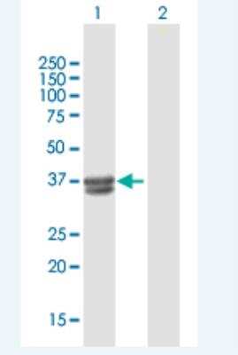 Western Blot: B3GALT6 Antibody [H00126792-B01P-50ug]