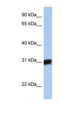 Western Blot: B3GALT6 Antibody [NBP1-62375]