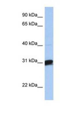 Western Blot: B3GALT6 Antibody [NBP1-69396]