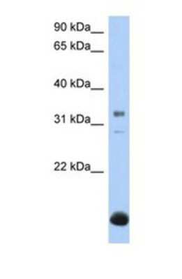 Western Blot: B3GALT6 Antibody [NBP1-69627]