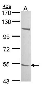 Western Blot: B3GALTL Antibody [NBP1-32787]