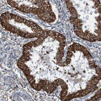 Immunohistochemistry-Paraffin: B3GAT2 Antibody [NBP1-81828]