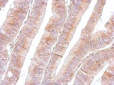 Immunohistochemistry-Paraffin: B3GNT3 Antibody [NBP1-32539]