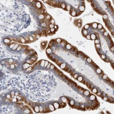 Immunohistochemistry-Paraffin: B3GNT3 Antibody [NBP1-88953]