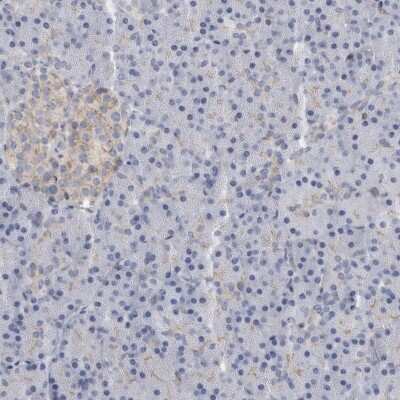 Immunohistochemistry-Paraffin: B3GNT3 Antibody [NBP1-88953]