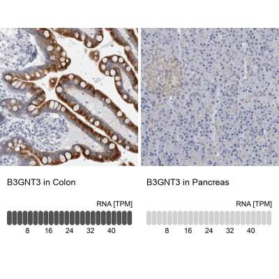 Immunohistochemistry-Paraffin: B3GNT3 Antibody [NBP1-88953]