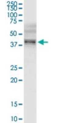 Western Blot: B3GNT3 Antibody [H00010331-D01P]