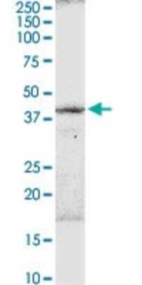 Western Blot: B3GNT3 Antibody [H00010331-D01P]