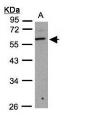 Western Blot: B3GNT3 Antibody [NBP1-32539]
