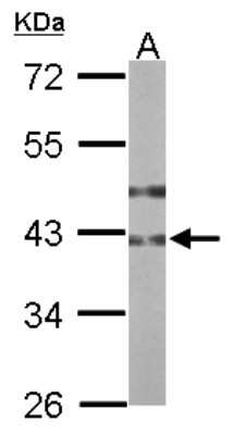 Western Blot: B3GNT3 Antibody [NBP1-32539]