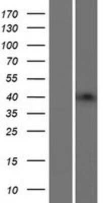 Western Blot: Beta-1,3-N-Acetylglucosaminyltransferase 4/B3GNT4 Overexpression Lysate [NBP2-06192]