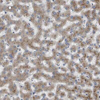 Immunohistochemistry-Paraffin: B3GNT5 Antibody [NBP1-88954]