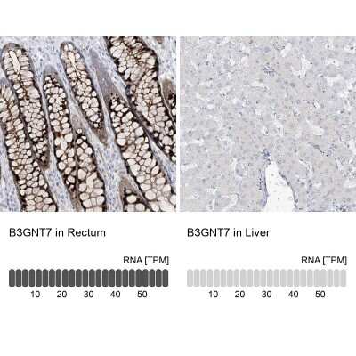 Immunohistochemistry-Paraffin: B3GNT7 Antibody [NBP1-88659]