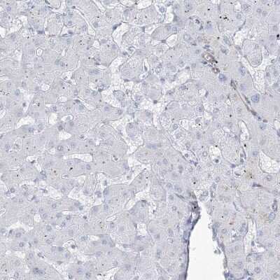 Immunohistochemistry-Paraffin: B3GNT7 Antibody [NBP2-34016]