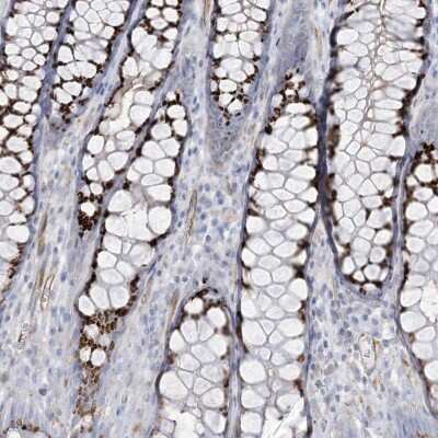 Immunohistochemistry-Paraffin: B3GNT7 Antibody [NBP2-34016]