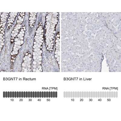 Immunohistochemistry-Paraffin: B3GNT7 Antibody [NBP2-34016]