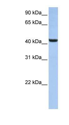 Western Blot: B3GNT7 Antibody [NBP1-62633]