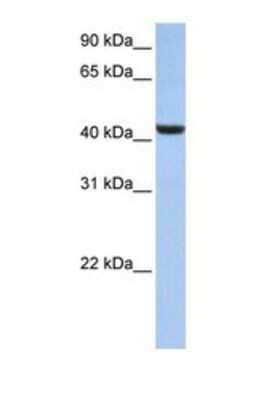 Western Blot: B3GNT7 Antibody [NBP1-69637]