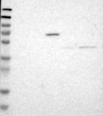 Western Blot: B3GNT7 Antibody [NBP3-17216]