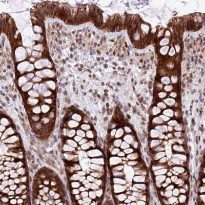 Immunohistochemistry-Paraffin: B3GNT9 Antibody [NBP2-30427]