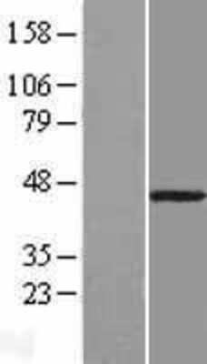 Western Blot: B3GNT9 Overexpression Lysate [NBL1-13077]