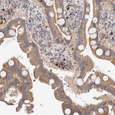 Immunohistochemistry-Paraffin: B3GNTL1 Antibody [NBP1-90838]
