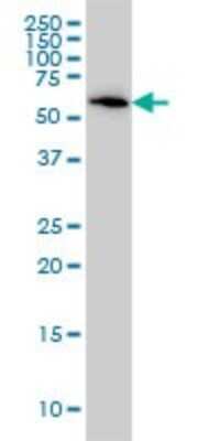 Western Blot: B4GALNT1 Antibody (5F9) [H00002583-M02]