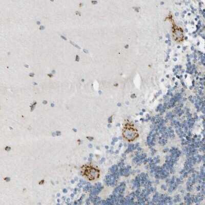 Immunohistochemistry-Paraffin: B4GALNT1 Antibody [NBP1-88662]